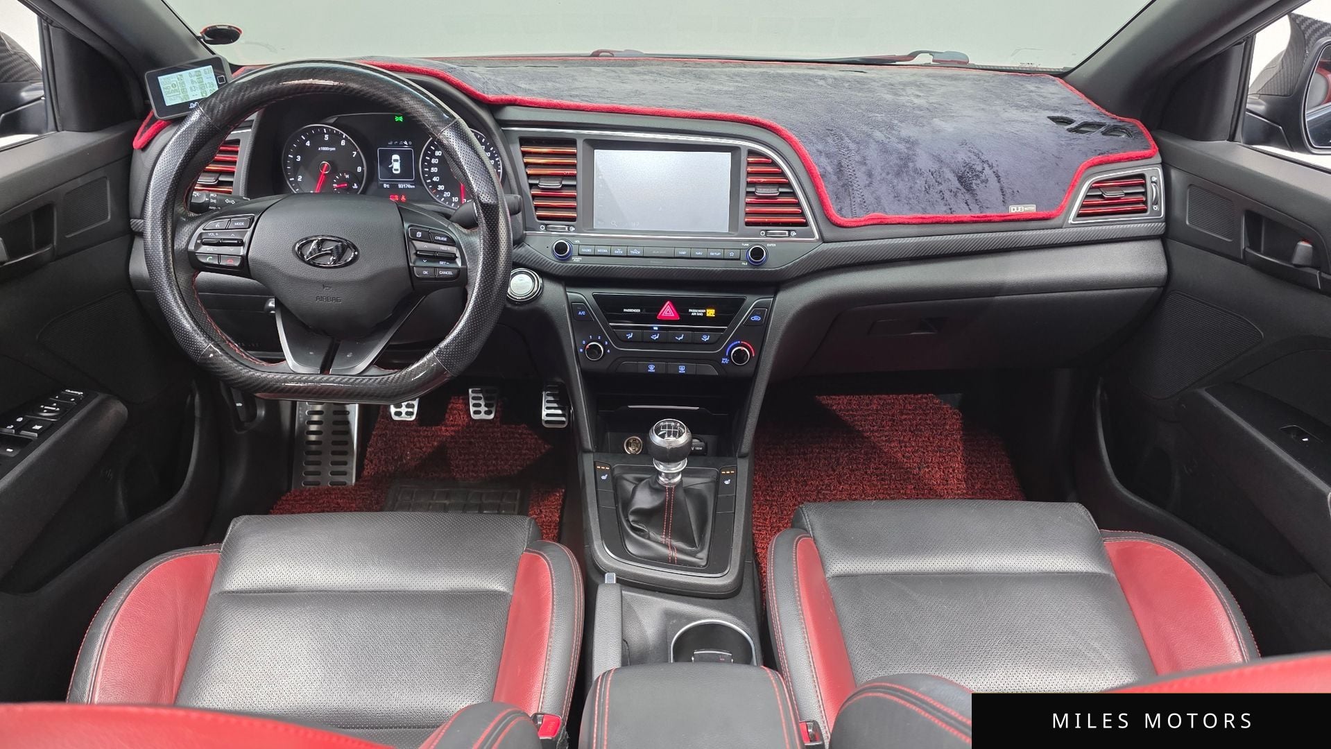 Hyundai AVANTE 2018 — миниатюра 7