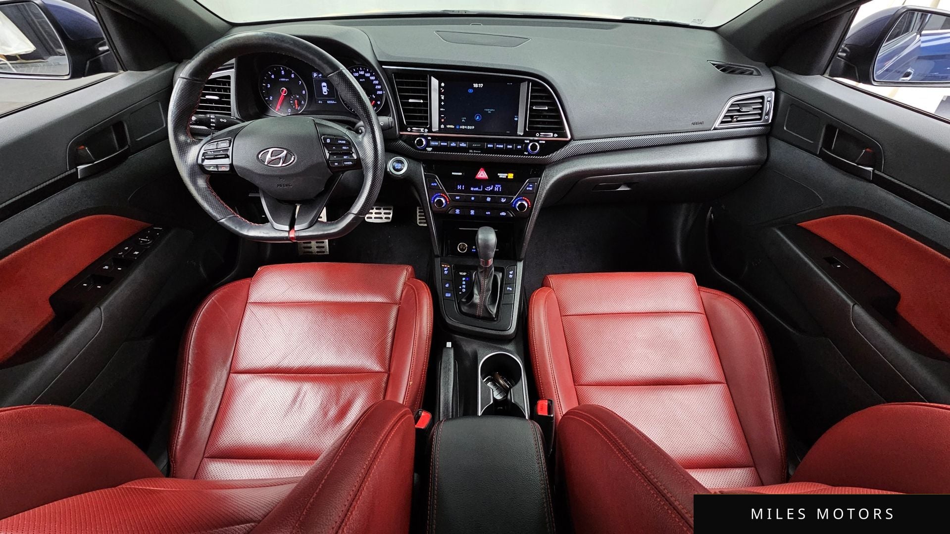 Hyundai AVANTE 2017 — миниатюра 7