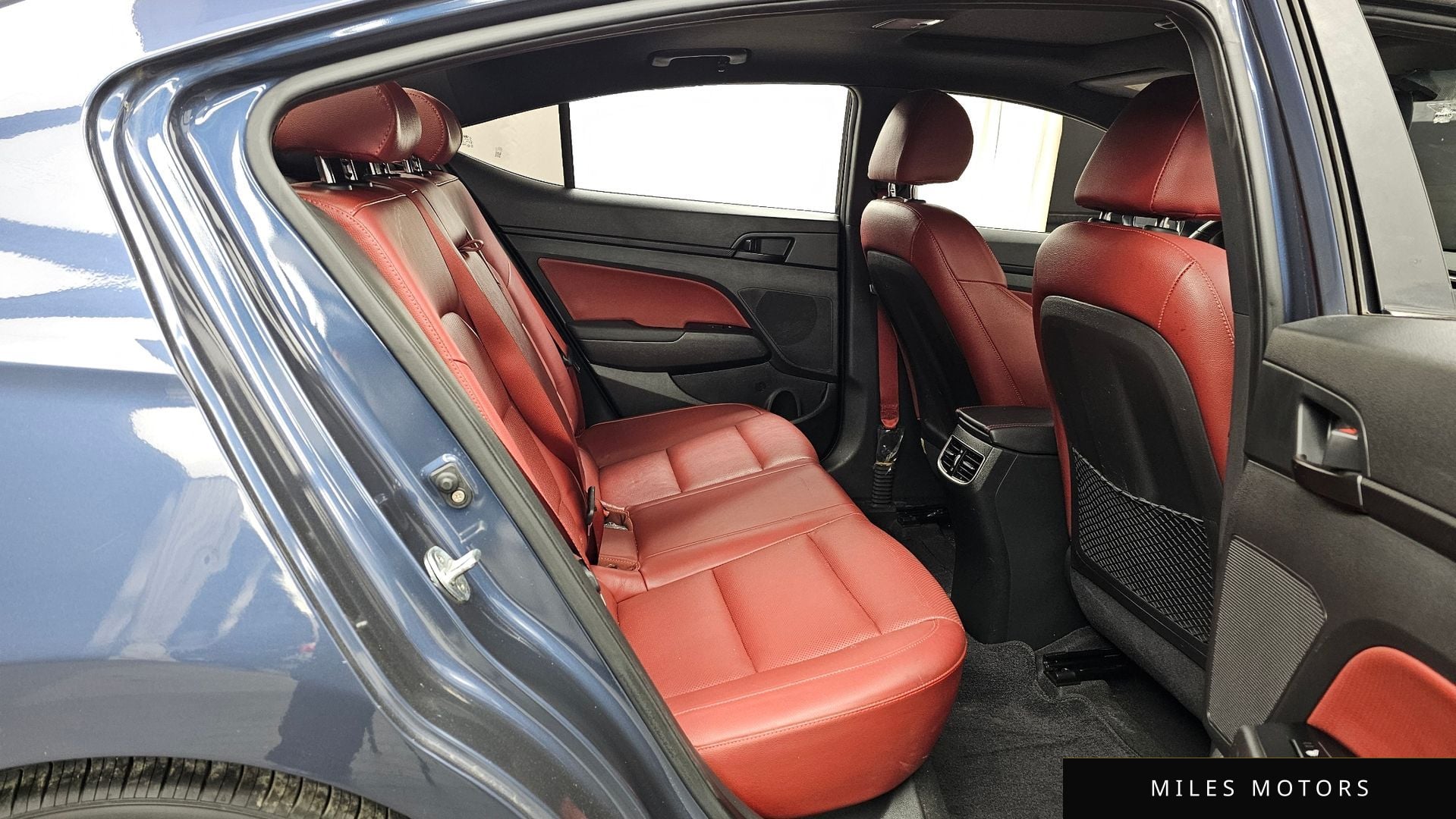 Hyundai AVANTE 2017 — миниатюра 12