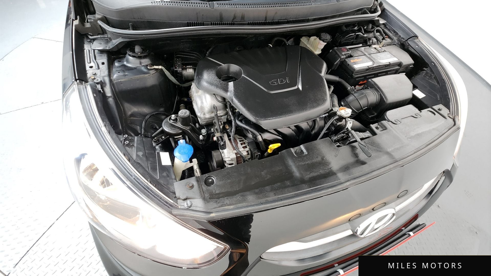 Hyundai Accent 2017 — миниатюра 6