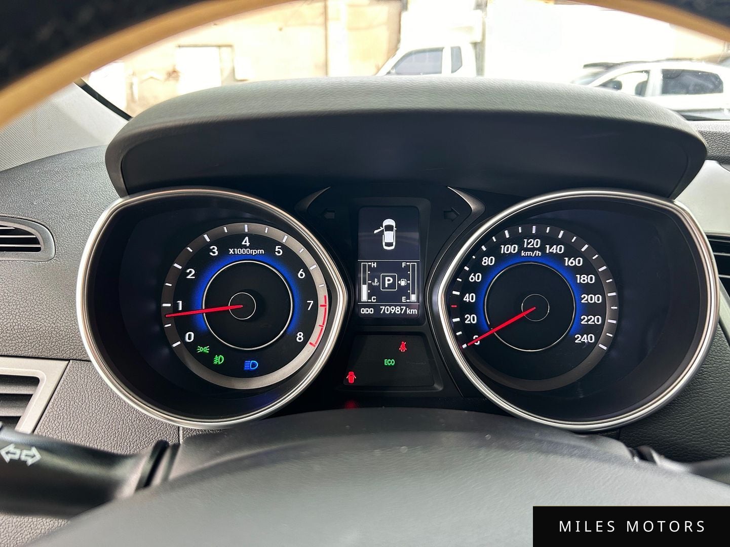 Hyundai AVANTE 2015 — миниатюра 6