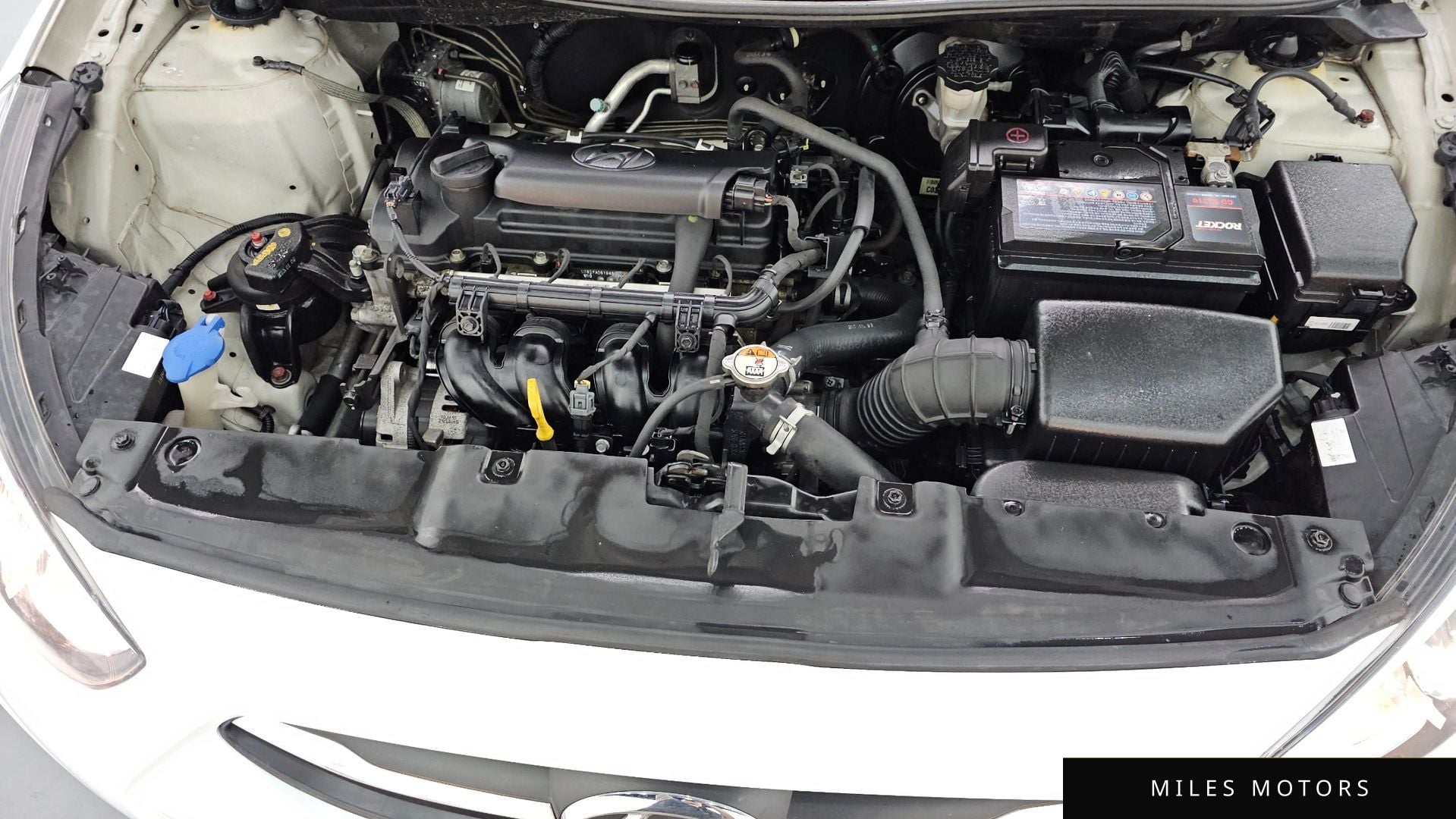 Hyundai Accent 2015 — миниатюра 6