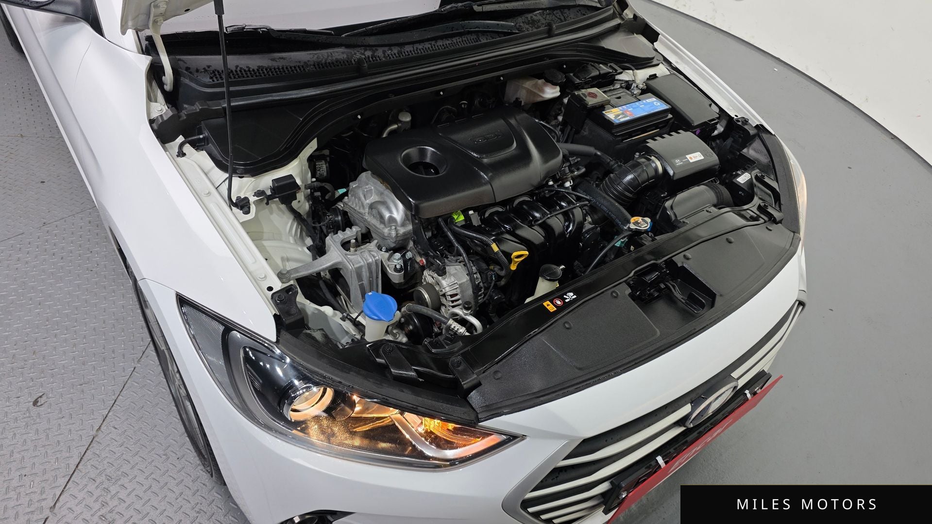 Hyundai AVANTE 2018 — миниатюра 6