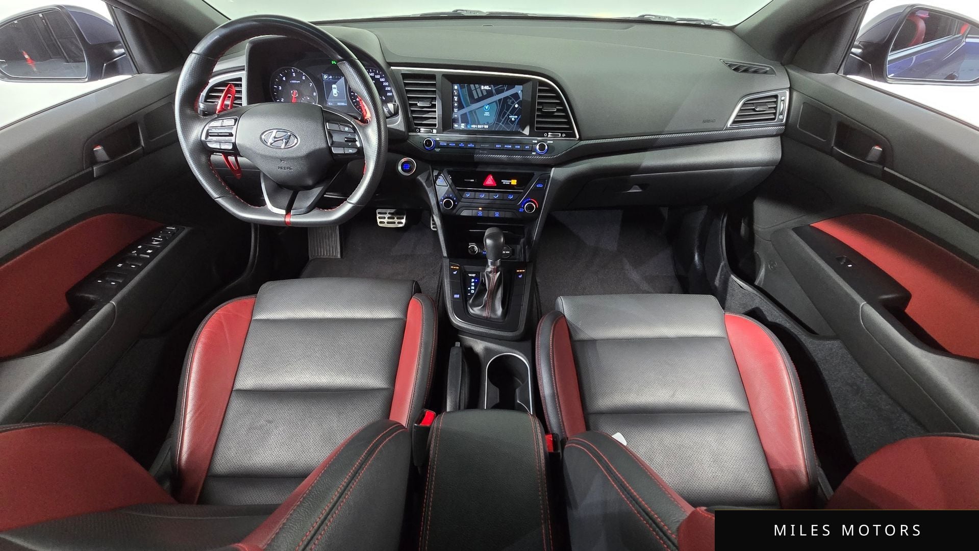 Hyundai AVANTE 2017 — миниатюра 7
