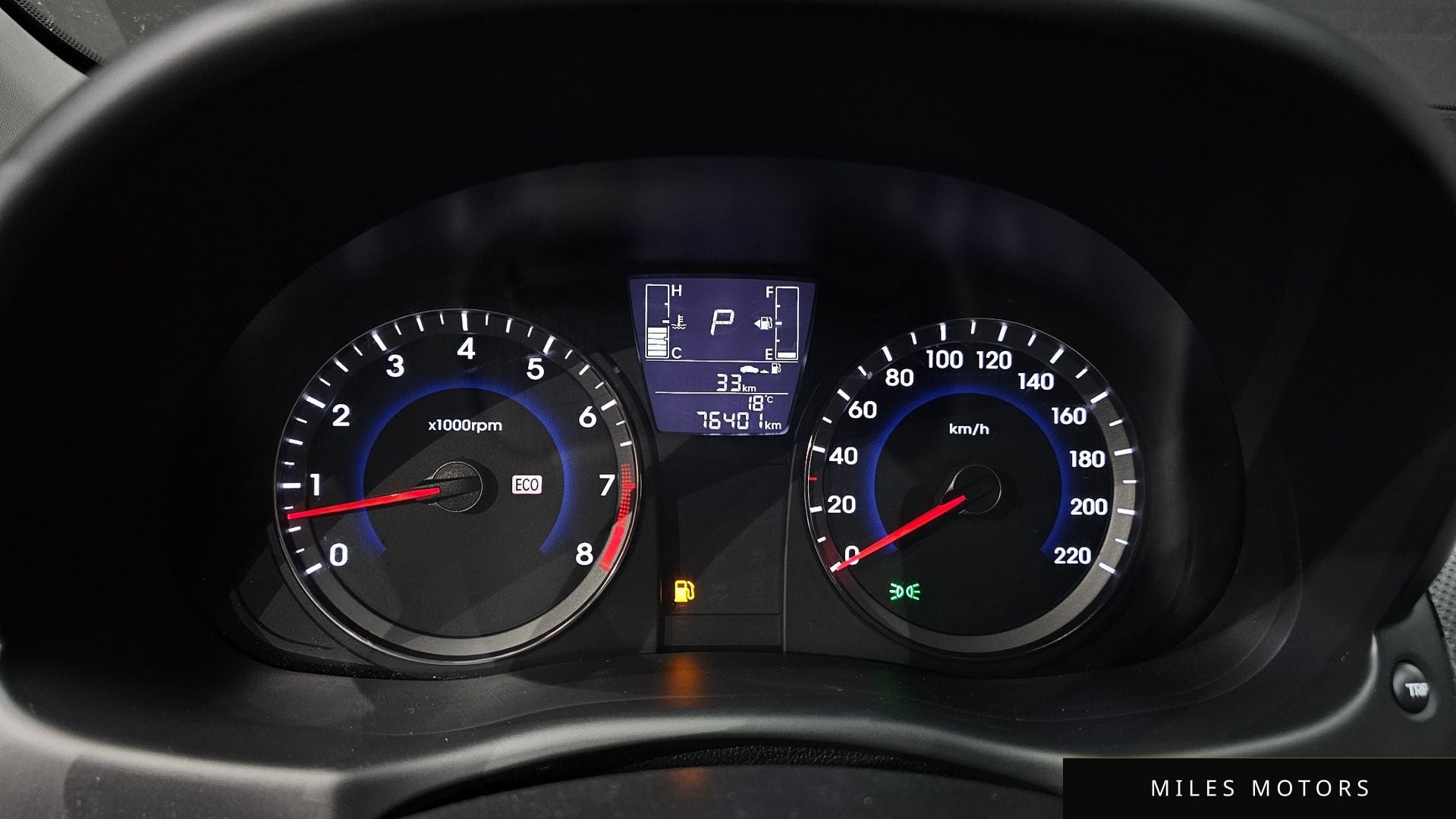 Hyundai Accent 2016 — миниатюра 11