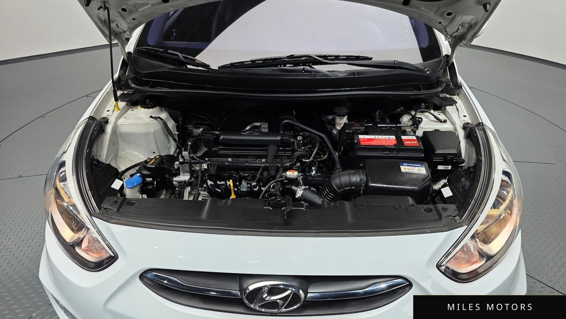Hyundai Accent 2015 — миниатюра 5