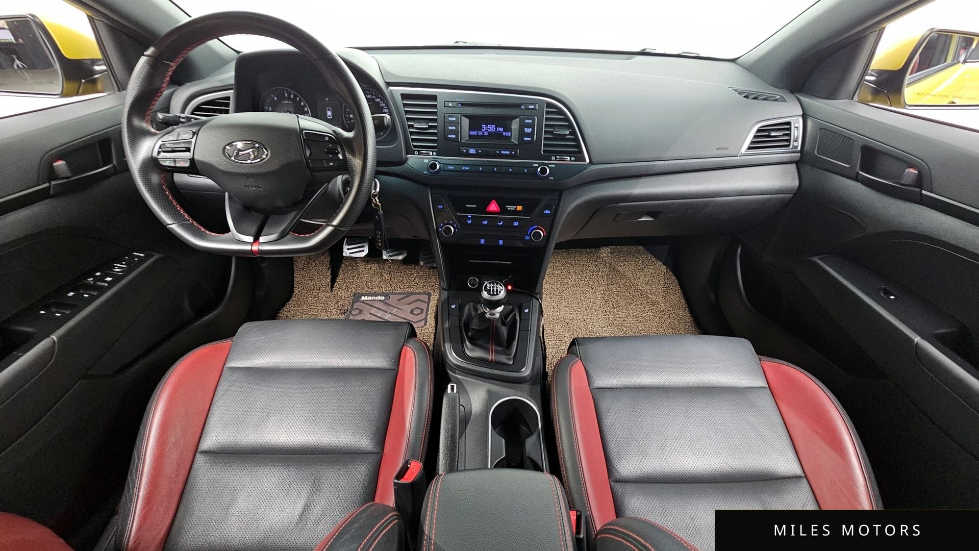Hyundai AVANTE 2017 — миниатюра 10