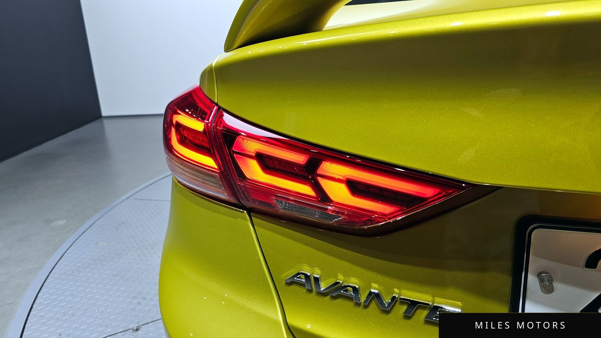 Hyundai AVANTE 2017 — миниатюра 9