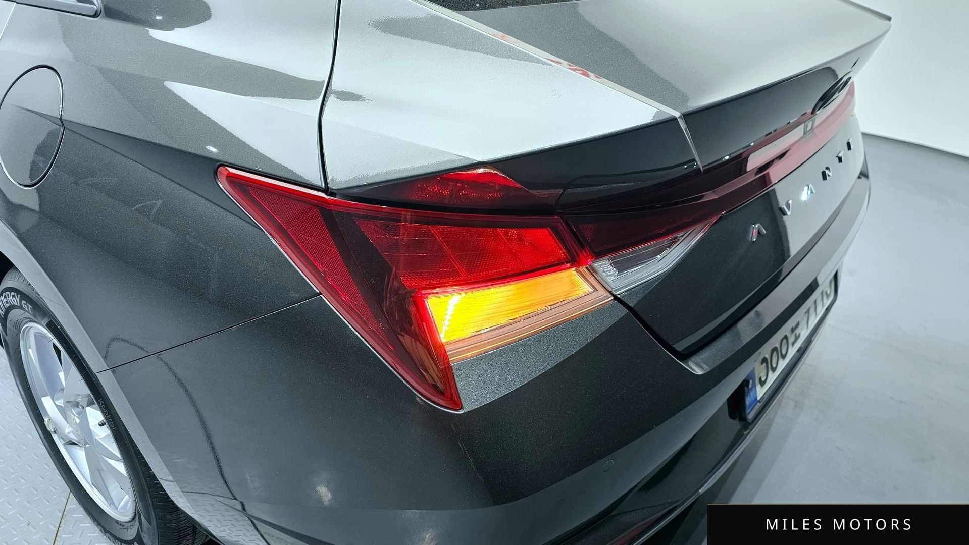 Hyundai AVANTE 2021 — миниатюра 9
