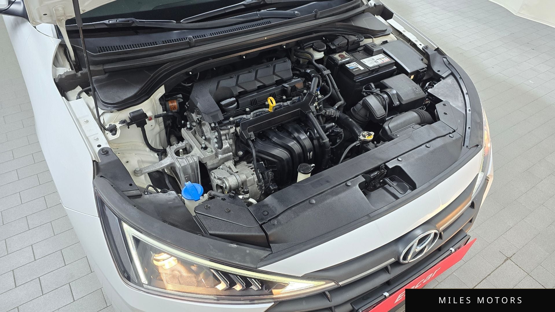 Hyundai AVANTE 2019 — миниатюра 6