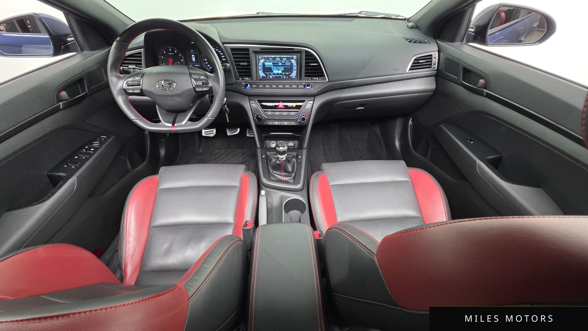 Hyundai AVANTE 2017 — миниатюра 10
