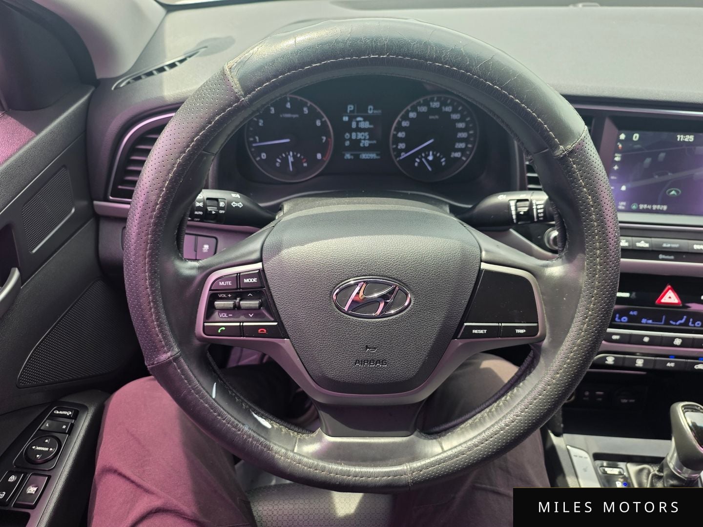 Hyundai AVANTE 2017 — миниатюра 11