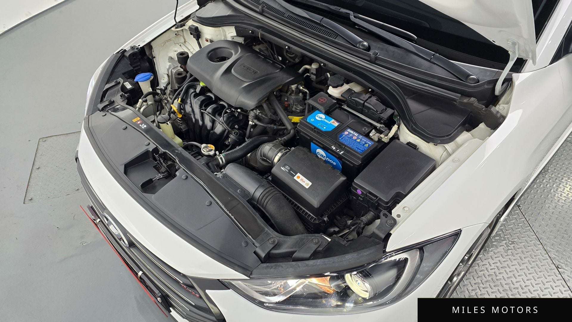 Hyundai AVANTE 2018 — миниатюра 5