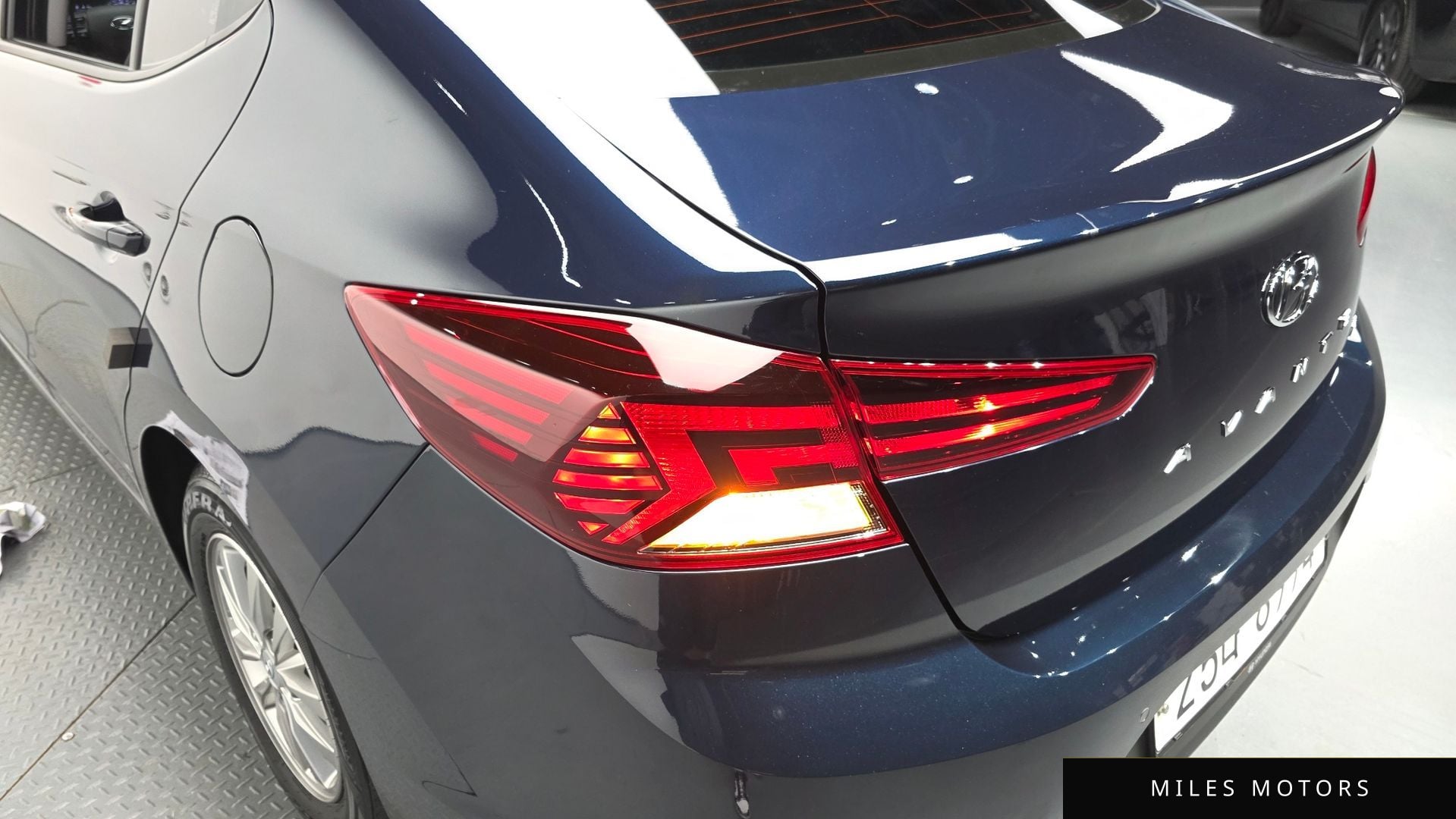 Hyundai AVANTE 2019 — миниатюра 8